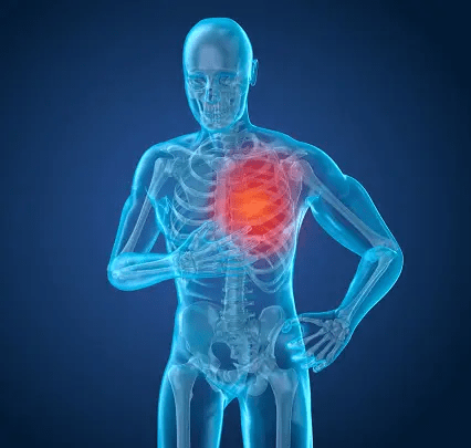 pulmonary hypertension