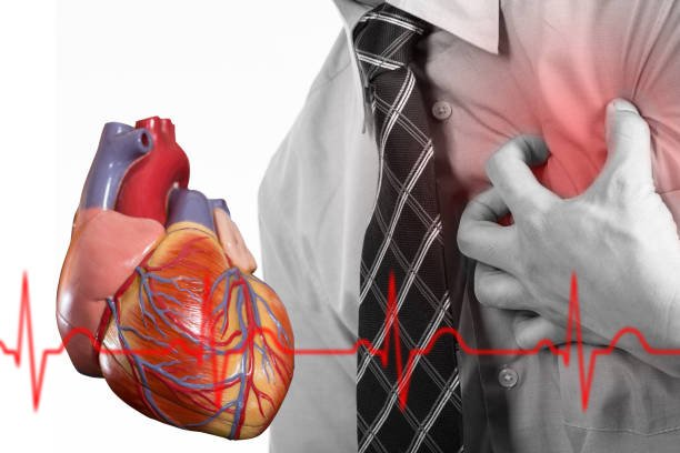 ischemic cardiomyopathy